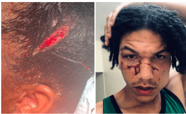 Screenshot_2019-09-15 NYPD Accused Of 'Barbaric' Brutality Following Raid On Marcy Houses Family Day.png